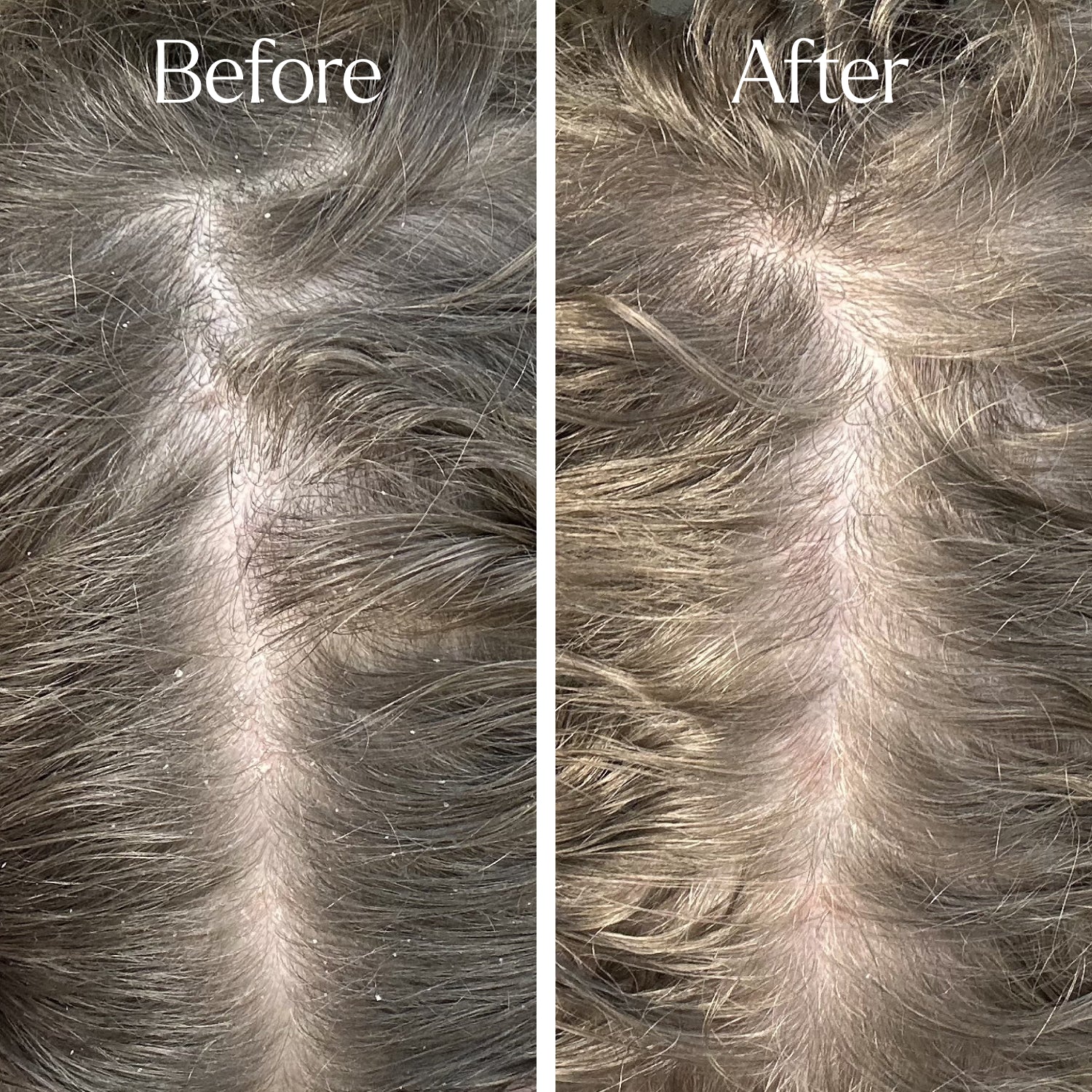 Clarify & Curl Starter Bundle - Image 4